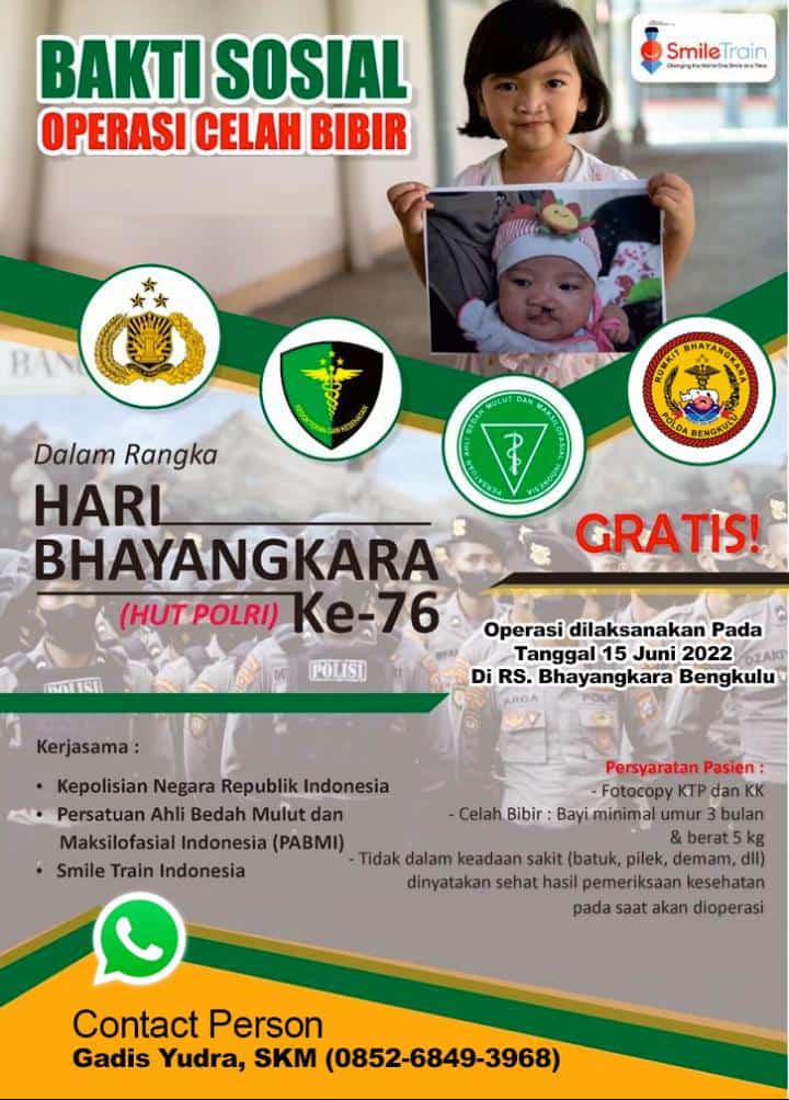 Peringati HUT Bhayangkara Ke-76, Polda Bengkulu Gelar Operasi Bibir Sumbing Gratis